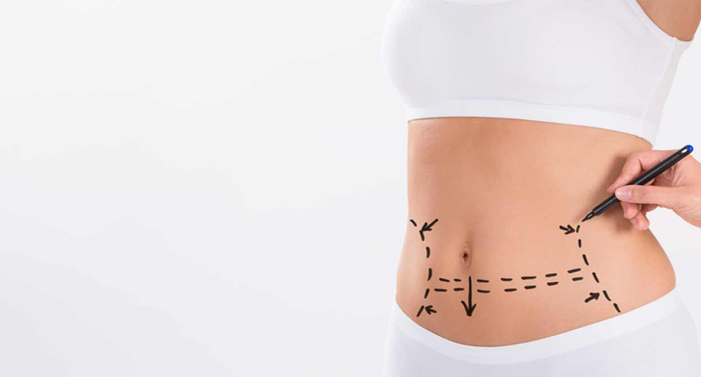 Body Shaping Treatment